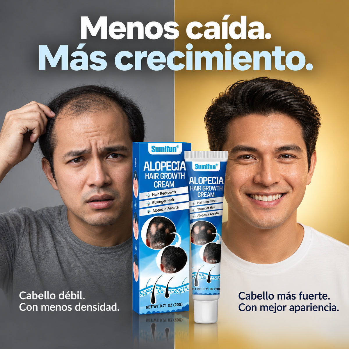 Sumifun™ – Crema Capilar para Zonas con Alopecia y Menor Densidad | Oferta 2×1