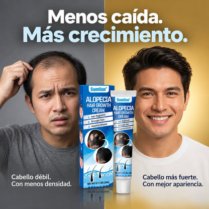 Sumifun™ – Crema Capilar para Zonas con Alopecia y Menor Densidad | Oferta 2×1